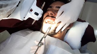 Tomando Anestesia no Dentista 🙆‍♂️🔥 100 coragem 😅 [upl. by Nyladnar]