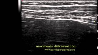 movimento diaframmatico  DIAFRAGMATIC MOVEMENT FUSAE APPROACH [upl. by Suzzy]