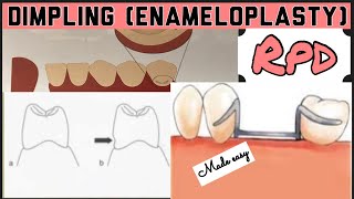 DIMPLING ENAMELOPLASTY II PROSTHETIC MOUTH PREPARATION II REMOVABLE PARTIAL DENTURE I PROSTHODONTICS [upl. by Kironde]