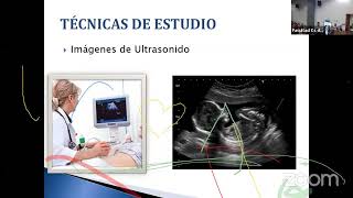 14032023  Proceso Biologico I [upl. by Keefer]