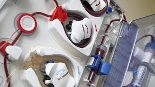 Hypertension in Dialysis Patients [upl. by Jerrome549]