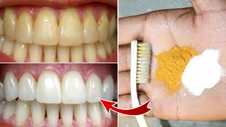 Magical Teeth Whitening home Remedy Get whiten Teeth at home in 3 minutes [upl. by Dal]