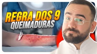 🔥REGRA DOS 09 QUEIMADURAS  REGRA DE WALLACE ATUALIZADO [upl. by Luwana649]