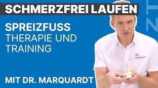 Spreizfuß  Ursachen Behandlung Übungen  SCHMERZFREI LAUFEN MIT DR MARQUARDT  ARTZT [upl. by Ailene]