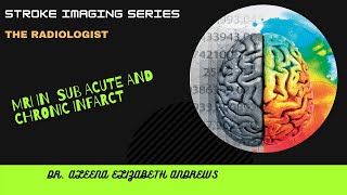 StrokeImagingSeries MRI subacute and chronic infarct Lecture 5 [upl. by Annabelle]