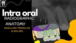 Intra Oral Anatomy Normal radiographic anatomical landmarksMaxilla premolar and molar region [upl. by Arst581]