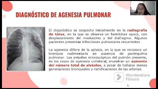 Agenesia pulmonar [upl. by Hsilgne]