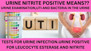 URINARY NITRITE TESTPOSITIVE URINARY NITRITEBACTERIA IN THE URINEURINARY TRACT INFECTION UTI [upl. by Nilyram]