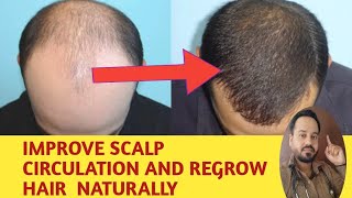 Fibrosis Calcification and Hair thinning  How to Regrow Hair Naturally [upl. by Orman905]