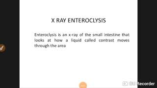 Ileocecal tb radiology [upl. by Saxen]