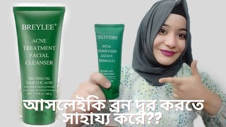 breylee acne treatment facewash review ব্রন দুর করতে এই ফেসওয়াশ টি কতটা সহায়ক [upl. by Dott]