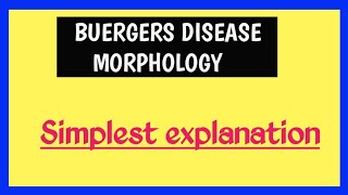 Buergers disease [upl. by Casey]