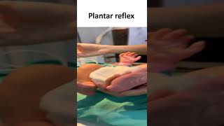 Plantar Reflex [upl. by Aicilram147]