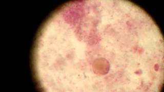 Blastocystis hominis Trophozoite [upl. by Naoj236]