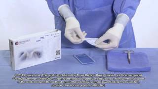 Control of bleeding in surgical procedures  Video abstract 90591 [upl. by Leugimsiul]