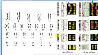 Hibridación genómica comparada en Gemelos [upl. by Lowis]