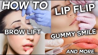 How To Inject Botox  Frown Forehead Brow Lift Gummy Smile and Lip Flip [upl. by Ramel482]