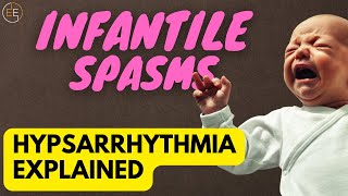 Hypsarrhythmia  What Is It What Does It Mean  Infantile Spasms [upl. by Enerak362]