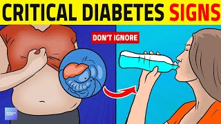 The 3 Critical Signs Of Diabetes You Shouldnt Ignore [upl. by Onailil]