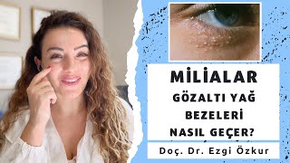 Milialar Nedir  Göz Altı Yağ Bezeleri  Yağ Kistleri Çözümü [upl. by Nipha]