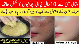 7 days Challange Multani Mitti Face Pack For Every Skin Type  How to Remove Acne And Pigmentation [upl. by Assej198]