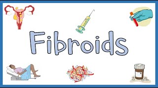 Uterine Fibroids  Types Causes Risk Factors Signs amp Symptoms Diagnosis amp Treatment [upl. by Rednasyl]