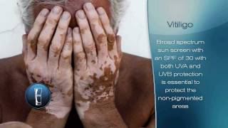 Vitiligo [upl. by Airat274]