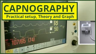 What is Capnography  Continuous Waveform Capnography  Sidestream Mainstream  Diagnotherapy [upl. by Dlarrej]