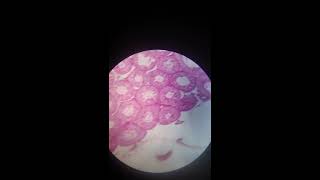 Testis and Epididymis Histology [upl. by Eehtomit]