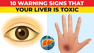 10 Warning Signs of a Toxic Liver [upl. by Skyla774]