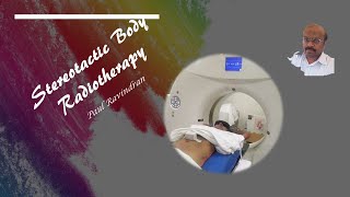 Stereotactic Body Radiotherapy [upl. by Westfahl]