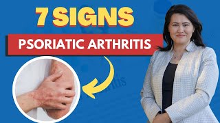 Psoriatic Arthritis 7 Signs and Symptoms  A Rheumatologist Review [upl. by Topliffe]