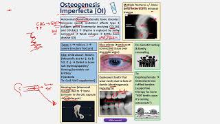 Osteogenesis Imperfecta CBL [upl. by Tonneson389]