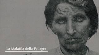 Pellagra In Italy Italian Version [upl. by Eimak145]