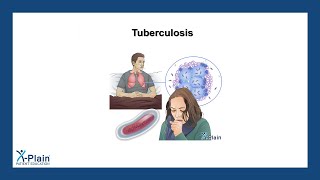 Tuberculosis [upl. by Annayak]