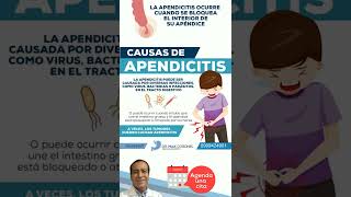 Apendicitis causas en Español [upl. by Janessa]