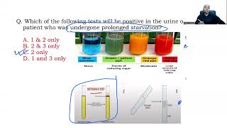 INICET Nov 2021 Biochemistry Recall [upl. by Gareri769]