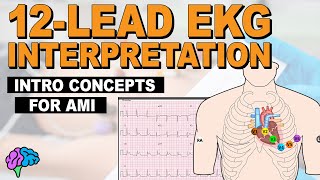 Introductory Concepts for Acute Myocardial Infarction AMI on 12Lead EKG [upl. by Ianteen636]