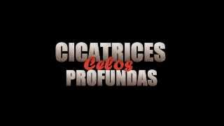 Cicatrices Profundas 2 Trailer [upl. by Glenn]