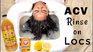 My FIRST ACV Rinse for Locs  Naturally Michy [upl. by Toni]