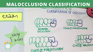 malocclusion of teeth I orthodontics lecture [upl. by Annasoh144]