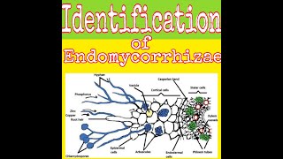 Identification of endomycorrhizae part 1 [upl. by Brant243]