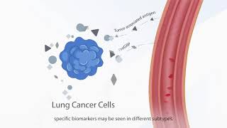 📍 The important tumor markers you must know about lung cancer [upl. by Annoya]