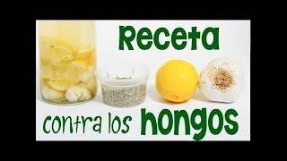 Como quitar los empeines con remedios naturales [upl. by Newra]