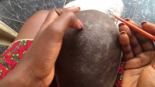 Dandruff Removal Asmr satisfying dandruff removal on a bald hair intense sound 🤯 dandruff [upl. by Annawot]