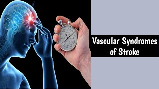 Vascular Syndromes Of StrokeStroke SyndromesTypes Of Stroke SyndromesVascular Stroke [upl. by Darn]