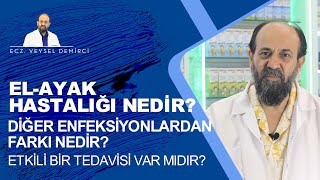 ELAYAK HASTALIĞI NEDİR DİĞER ENFEKSİYONLARDAN FARKI NEDİRETKİLİ BİR TEDAVİSİ VAR MIDIR [upl. by Ollopa309]