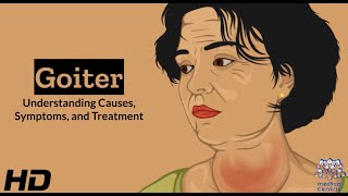 Thyroid Troubles Navigating Goiter  Causes Symptoms and Treatment Explained [upl. by Rolyks]