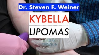 Kybella treating Lipomas done by Dr Steven F Weiner [upl. by Amilah242]