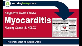 Nursing KAMP Myocarditis Infective Disease [upl. by Lenora251]